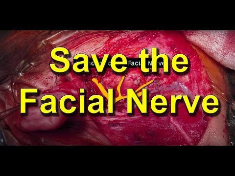 How To Save The Facial Nerve During Parotid Salivary Gland Cancer Surgery