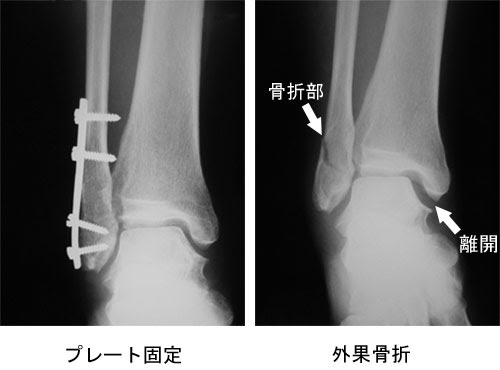 痛みの話q A 八王子整形外科 西八王子駅近くの整形外科専門クリニック