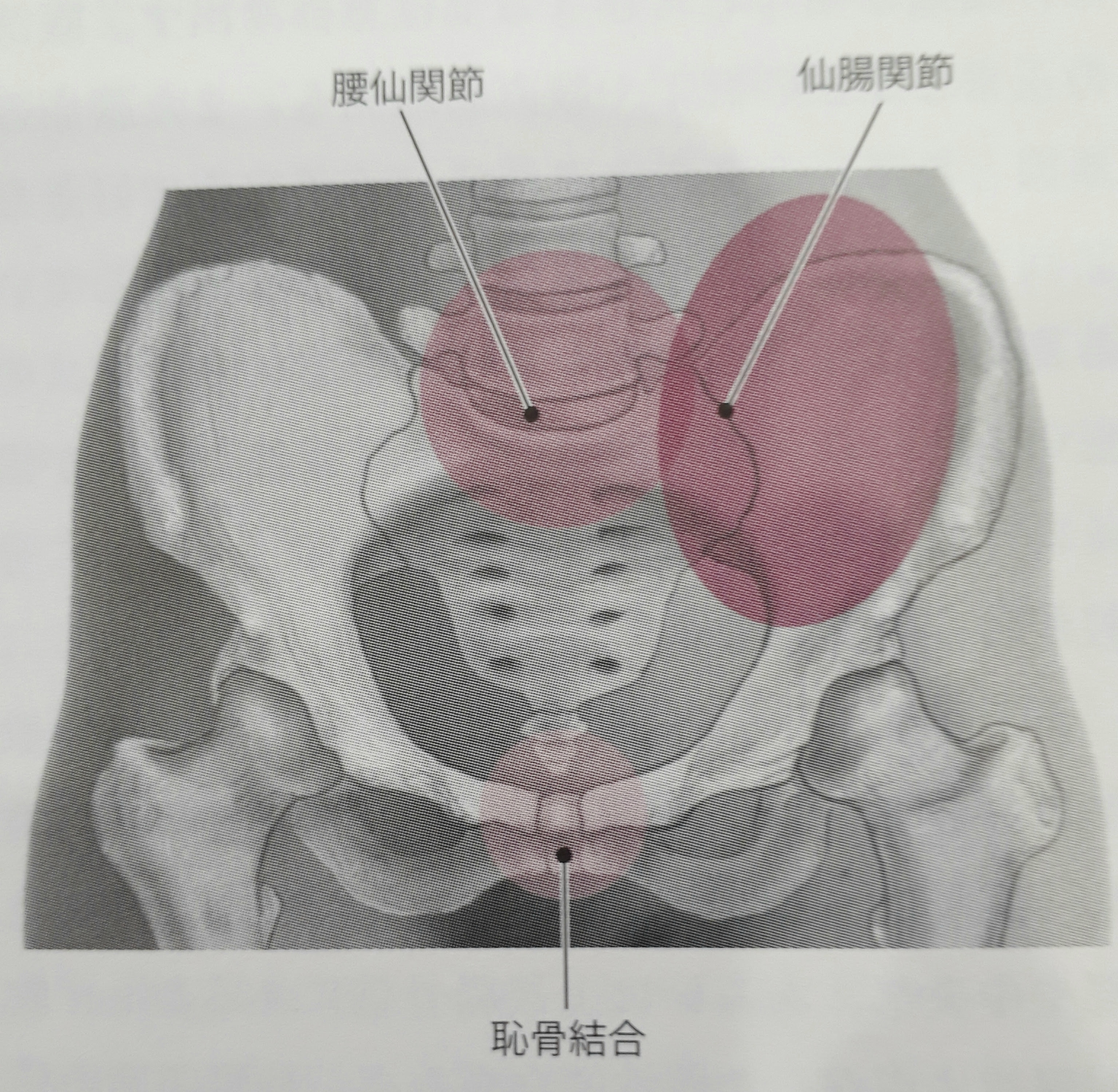 妊娠中 産後の恥骨痛 大分市の骨盤矯正 妊婦整体 しきさい整骨院