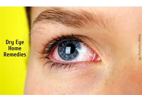 Now, the board is all set to release the cbse term 1 result date 2021 for class 12th arts, . Dry Eyes: Natural Home Remedies For The Dry Eyes Syndrome