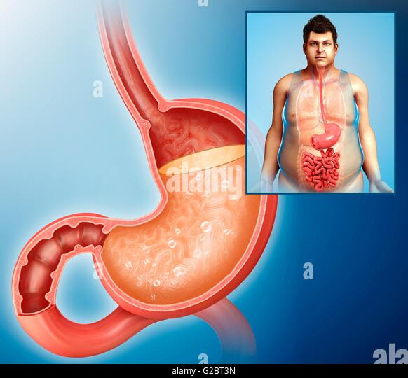 Stomach Acid Stock Photos &amp; Stomach Acid Stock Images - Alamy