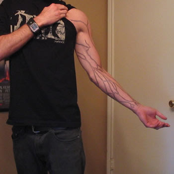 veins of arm. major veins of the arm)