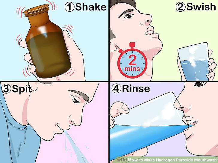 Make Hydrogen Peroxide Mouthwash Step 9.jpg