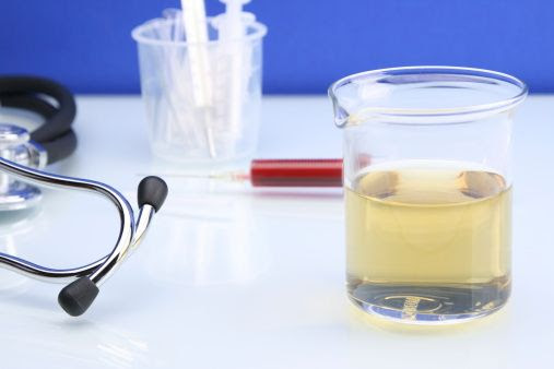 Blut Im Urin Ursachen Bei Frau Mann
