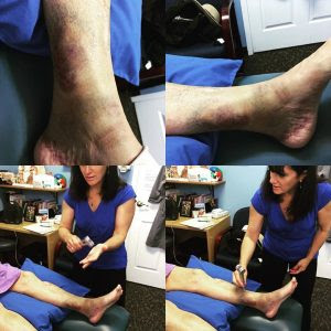 Patient with Pelvic Pain and Constipation Presents with ...