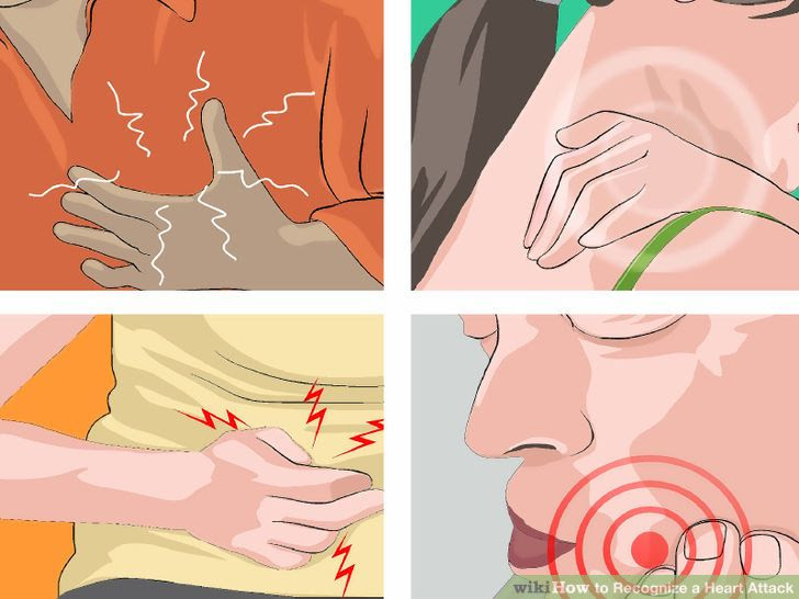 Recognize a Heart Attack Step 2 Version 3.jpg