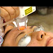 Face Laser Treatment In Mumbai Download Sound Mp3 and Mp4