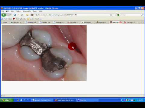 Prostate Fix-Up 2, Prostatitis Solutions