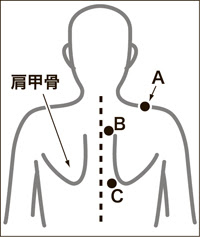 首 肩 肩甲骨の痛みの治療法 このヘルシーコラムでは 身近にある頑固な痛みと神経ブロックという治療法について説明していますが いまだに 何回もブロックすると身体に悪いのでは ブロックすると骨がもろくなると言われた といった話を耳