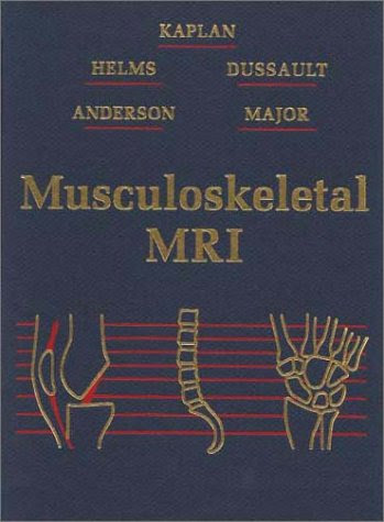 Musculoskeletal Mri, by Phoebe A. Kaplan, Robert Dussault, Clyde A. Helms, Mark W. Anderson