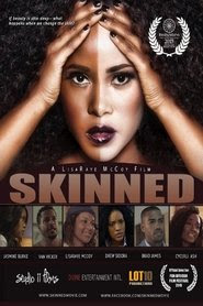 Film Skinned 2014 En Anglais