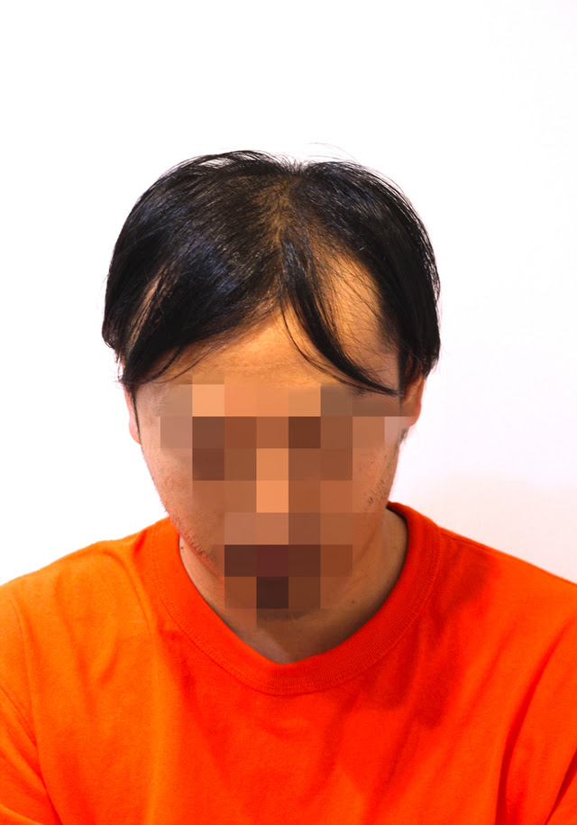 40代m字からu字移行期の薄毛をカットでかっこいい髪型に Inti Report