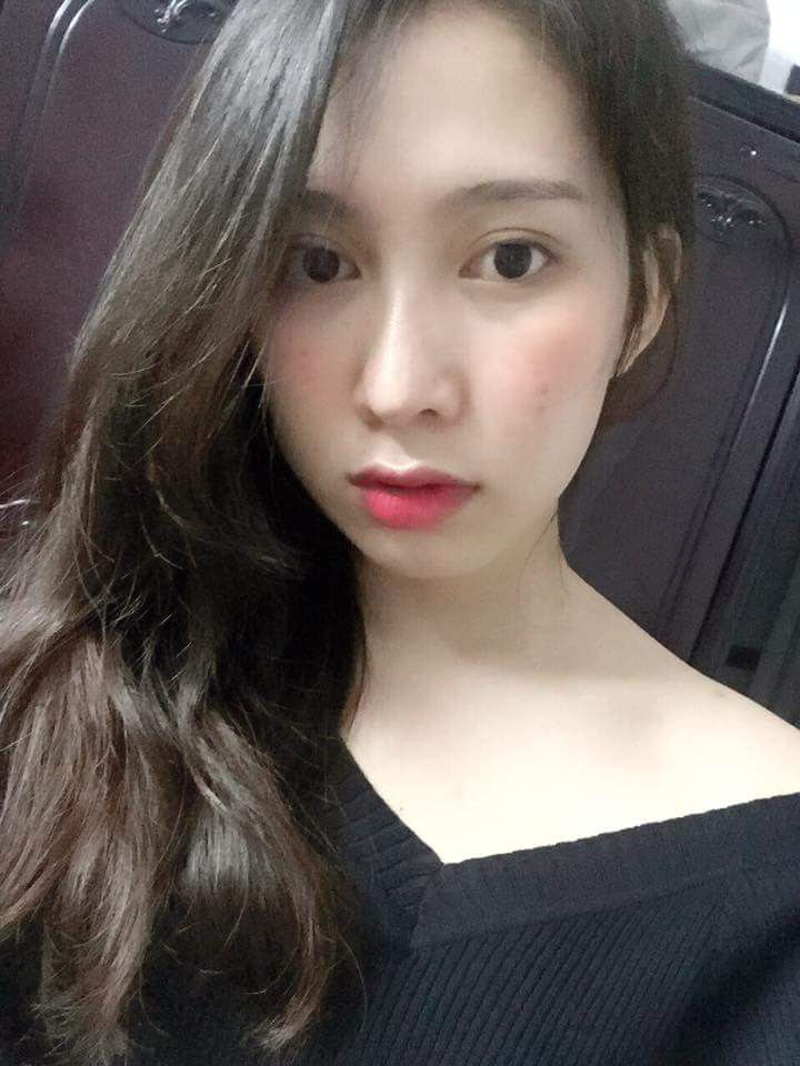 cam-tien-sau-sua-mui-1