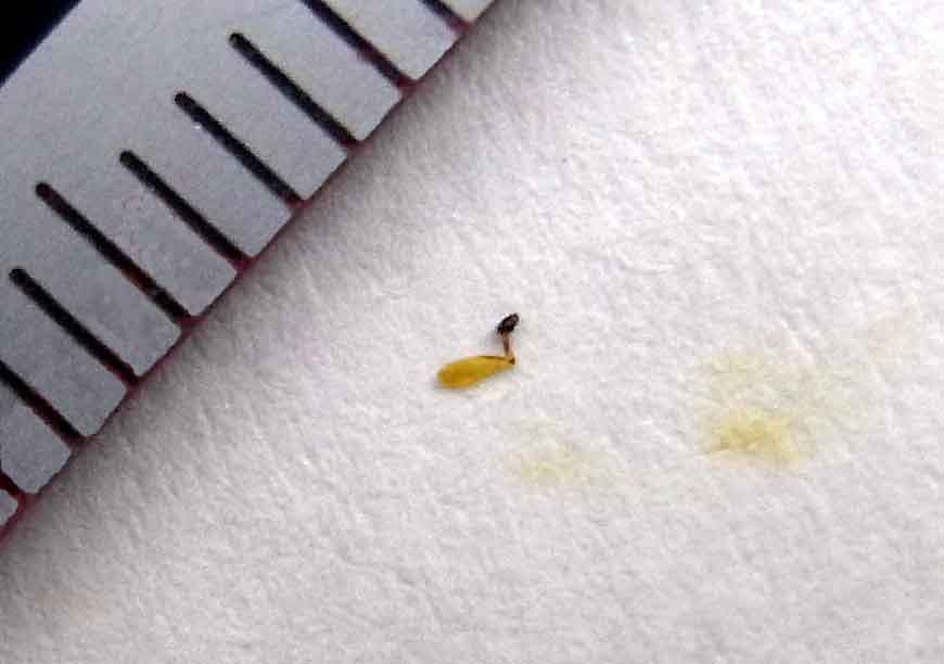 最も欲しかった ピアス 穴 白い塊 ピアス 穴 白い塊