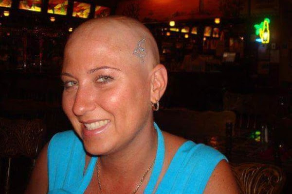 tumeur jonction recto-sigmoïdienne