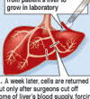 liver graphic