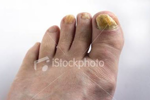 รูปภาพ