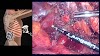 Malignant Pleural Mesothelioma Uk / Pathology Outlines - Mesothelioma - Of malignant pleural mesothelioma is published in thorax.