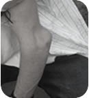 Hypnotherapy Dangers