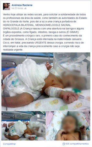 Andreza Raclene faz apelo nas redes sociais para conseguir cirurgia para o bebê (Foto: Reprodução/Facebook de Andreza Raclene)