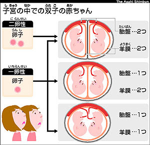 Asahi Com 双子はおなかでどう育つの ののちゃんのｄｏ科学 ｎｉｅ 教育