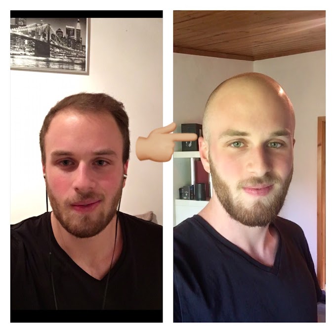 U Shaped Hairline Hairstyles - 57 Ideas For Hairstyles Men Asian Round Faces | Hairstyles ... : This trimmed side is the key thing here which will help to draw all attention from the receding hair lines.