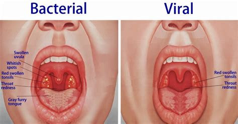 whats  difference   virus   bacteria