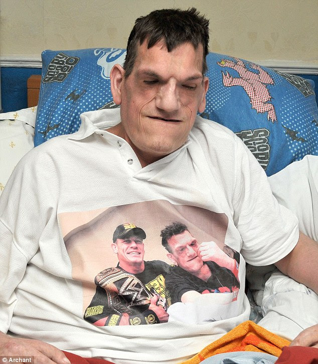 Trapped: Robert Smith, 24, suffers from proteus syndrome