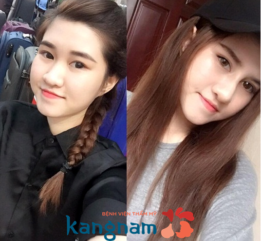 co-nen-nang-mui-sline-khong-3