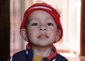  Correction of the shape and size of the ears (otoplasty)  