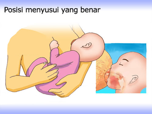 Panduan Mengatasi Hambatan Menyusui: 