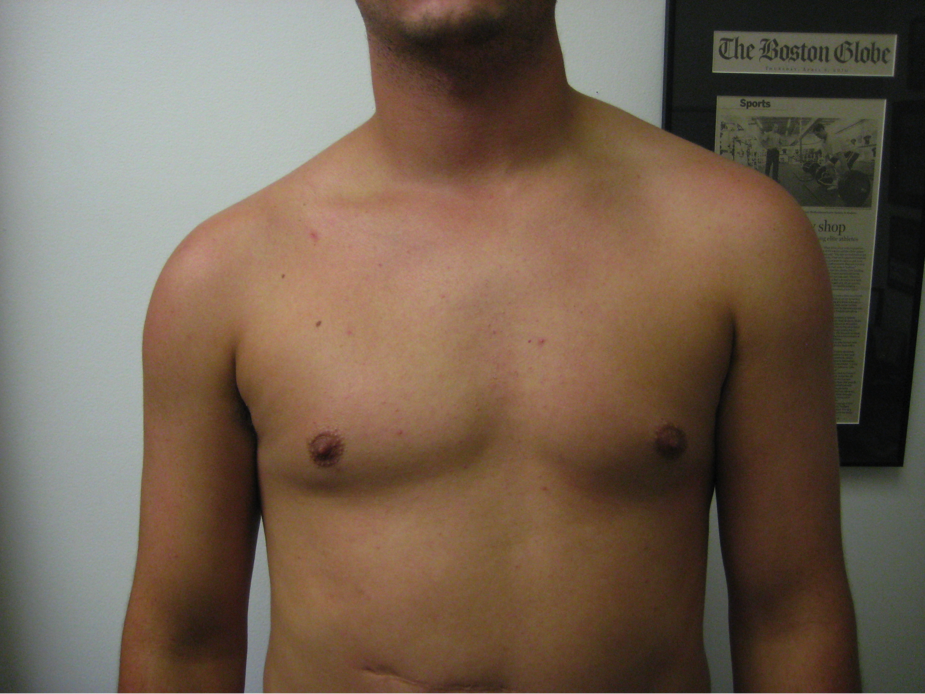 claivicle