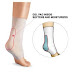 Haglund Deformity - Ortho Dx A Deformity Resulting From Rigid Footwear Clinical Advisor : Haglund's deformity is the term used to describe an enlargement of the posterior/lateral heel.