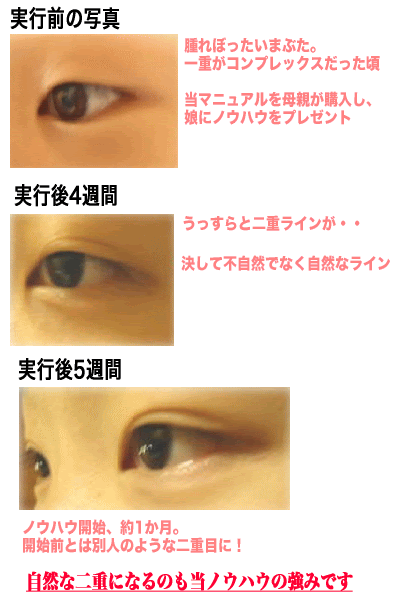 二重まぶた自力でなる 二重まぶたに自力でなる方法