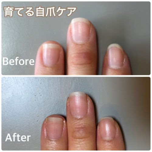 ピンクの部分を伸ばして キレイな自爪にしたい お客さまのビフォーアフター 自爪ケア専門サロン イニュラ