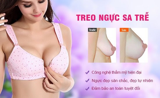 Kỹ thuật áp dụng treo ngực sa trễ có an toàn không