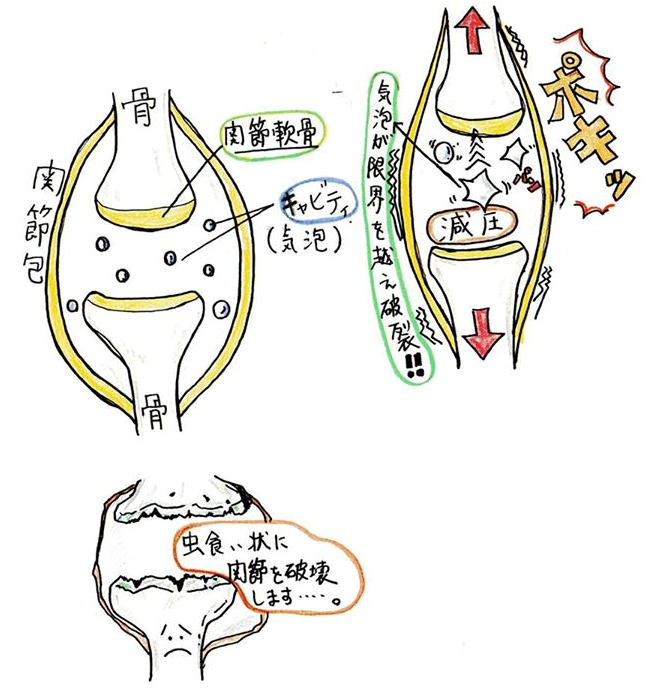 関節をポキポキ鳴らすのは止めましょう 町田で肩こり 腰痛治療なら根本改善治療の加藤整骨院