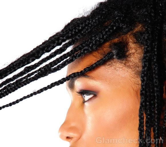  Alopecia on Traction Alopecia Is A Hair Loss Condition That Affects Men And Women