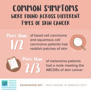 Skin Cancer Acronym - Skin Cancer Patientsâ Difficult Road to Diagnosis | Health Union, LLC