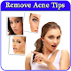 Download Remove Acne in 7 Days Guide For PC Windows and Mac 1.0