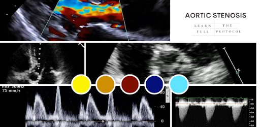AORTIC STENOSIS PROTOCOL GUIDE