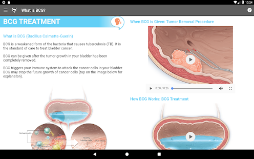 BCG Treatment(圖6)-速報App