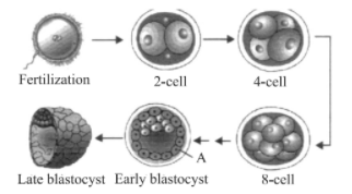 Infertility