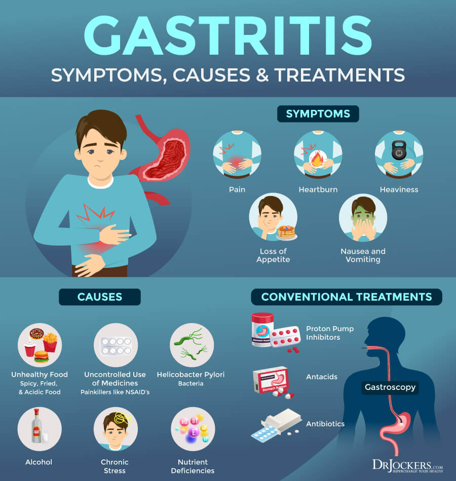 Gastrit-Infografik