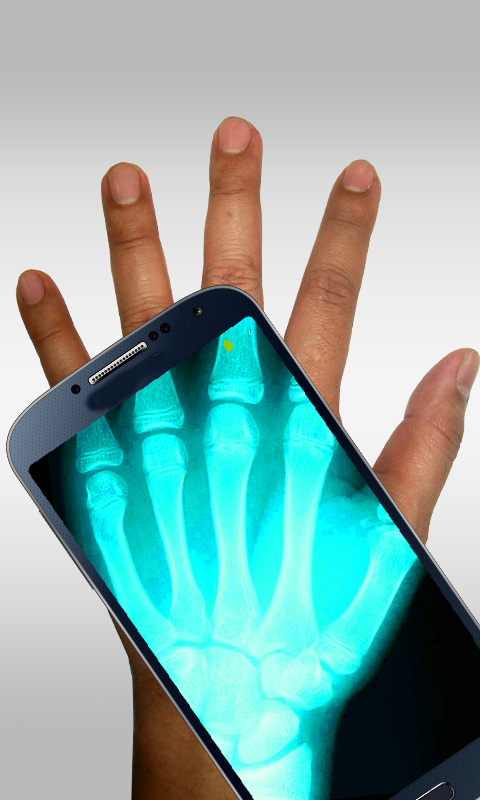 Xray Screen 3