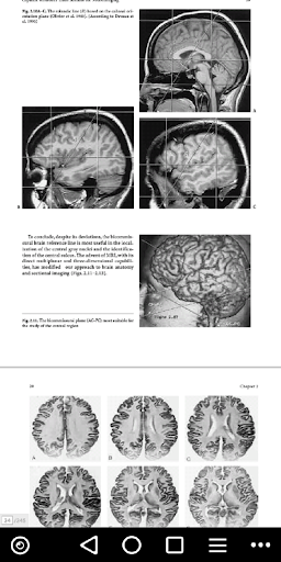 MRI - Regional Anatomy of the Brain Using MRI