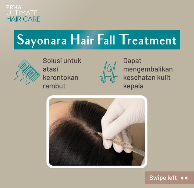 SOLUSI RAMBUT RONTOK DAN KEBOTAKAN DENGAN ERHA ULTIMATE