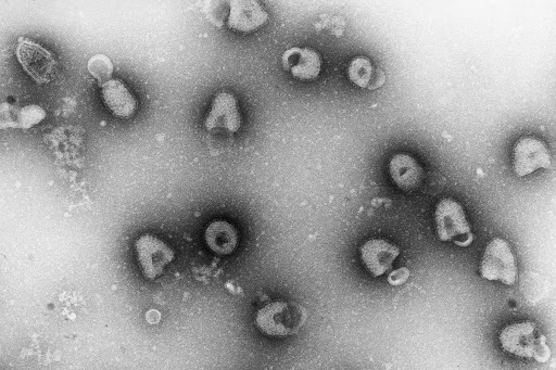 Virus de la rage en microscopie électronique.