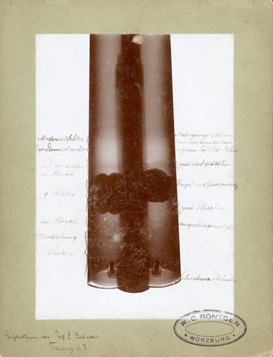X-Ray of Röntgens hunting rifle.