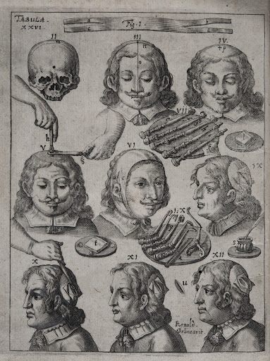 Johannes Scultetus: Wund-Artzneyisches Zeug-Hauß